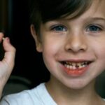 متى يبدأ الطفل بتبديل اسنانه اللبنية