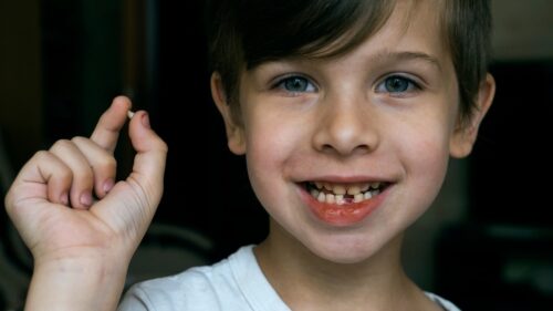 متى يبدأ الطفل بتبديل اسنانه اللبنية